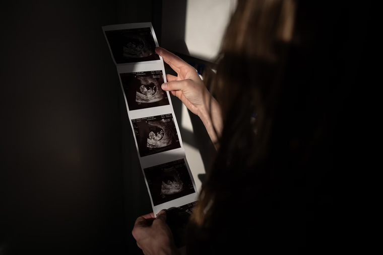 Cuộc đời ngắn ngủi của Milo ảnh 1