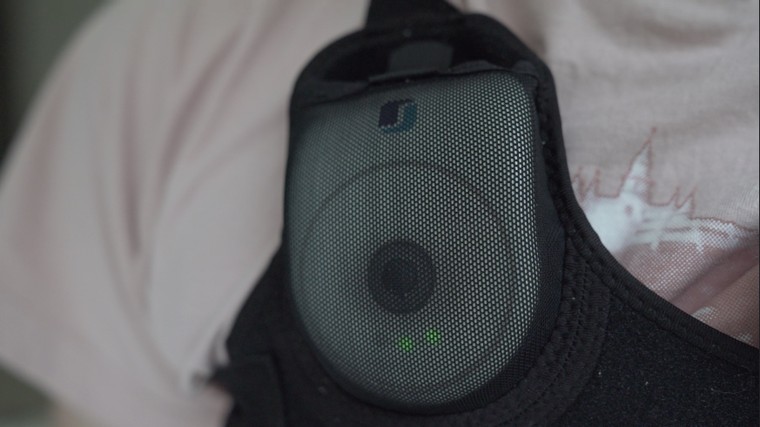 Bệnh nhân trầm cảm “tái sinh” nhờ chip xoa dịu cảm xúc ảnh 2