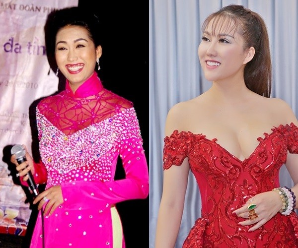 Loạt sao Việt công khai phẫu thuật thẩm mỹ năm 2017 ảnh 2