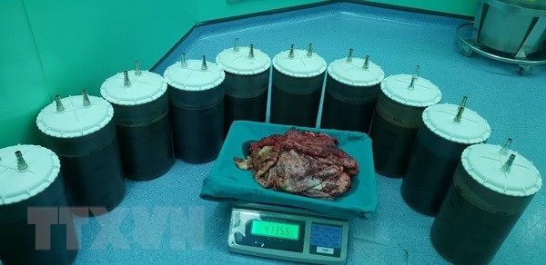 TP.HCM: Phẫu thuật lấy khối u buồng trứng lớn hiếm thấy ảnh 1