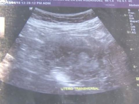 Ngạc nhiên với cụ bà mang thai đứa con thứ 8 ở tuổi 70 ảnh 1