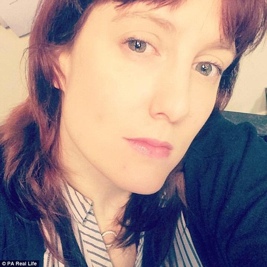 Mù mắt chỉ vì 20 phút đeo kính áp tròng xuống hồ bơi ảnh 1