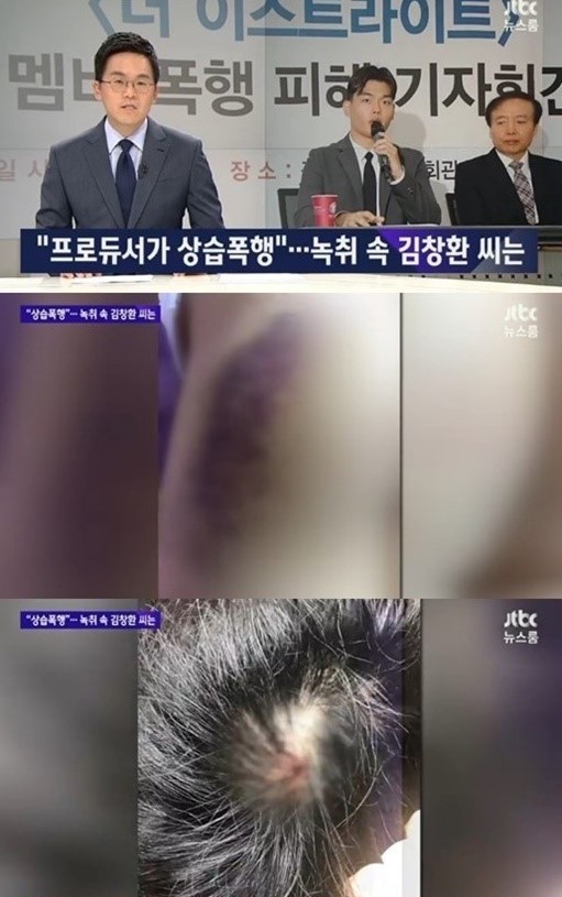 Dư luận Hàn Quốc phẫn nộ khi nhóm nhạc nhỏ tuổi bị đánh đập, bạo hành ảnh 1