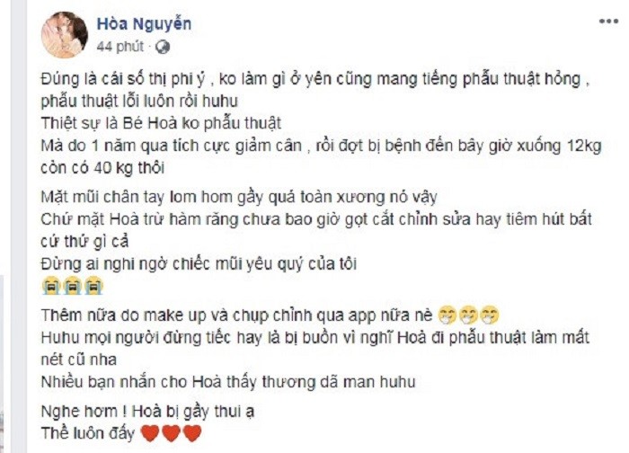 Hòa Minzy đáp trả tin đồn phẫu thuật thẩm mỹ ảnh 1