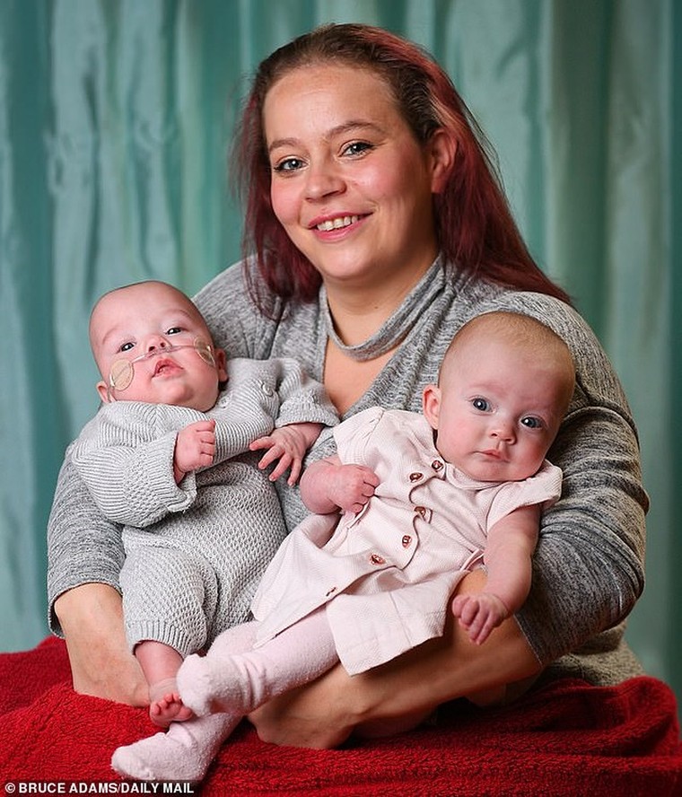 Kì lạ cặp song sinh ra đời cách nhau 12 ngày ảnh 1