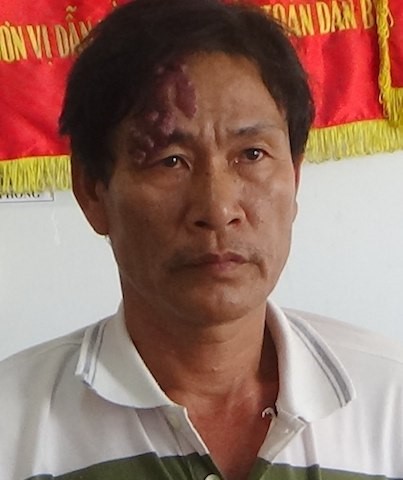 'Yêu râu xanh' xâm hại tình dục rồi cho bé gái 20.000 đồng ảnh 1