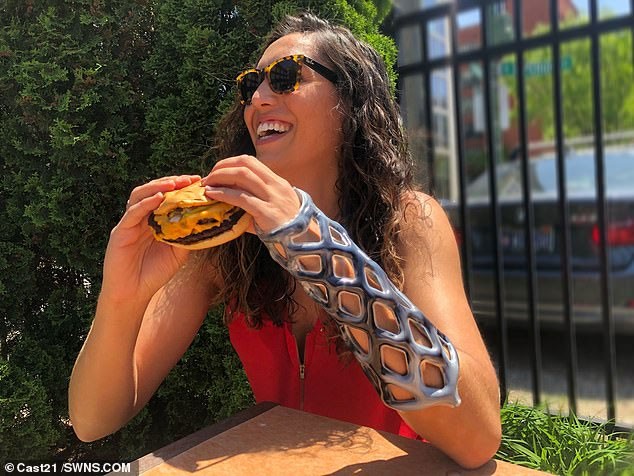 Khuôn bó bột kiểu mới không gây ngứa, không mùi, không cần cắt bằng cưa ảnh 1