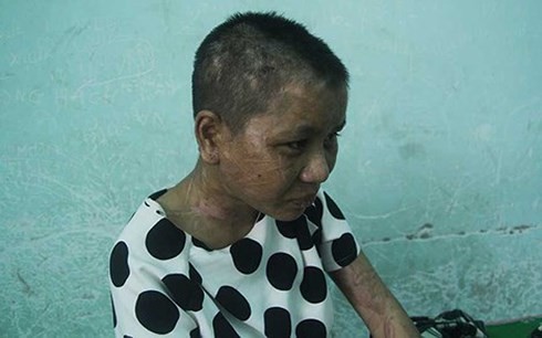 Kẻ hành hạ người làm ở Gia Lai sẽ phải đối diện với hình phạt nào? ảnh 1