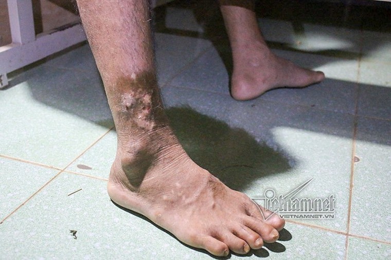 Lụt lịch sử ở Chương Mỹ: Bơi thuyền tiếp tế thức ăn, lở loét vì lội nước ảnh 14