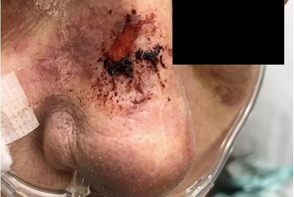 Người phụ nữ tử vong sau khi dùng nước rửa mũi chữa viêm xoang ảnh 1