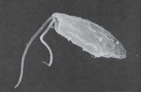 Người phụ nữ tử vong sau khi dùng nước rửa mũi chữa viêm xoang ảnh 3