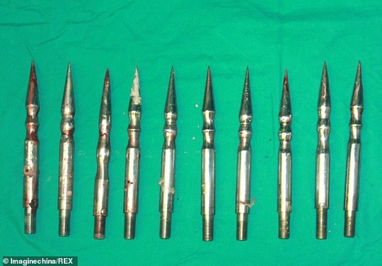 Công nhân Trung Quốc bị robot xiên 10 đinh thép khắp cơ thể ảnh 2