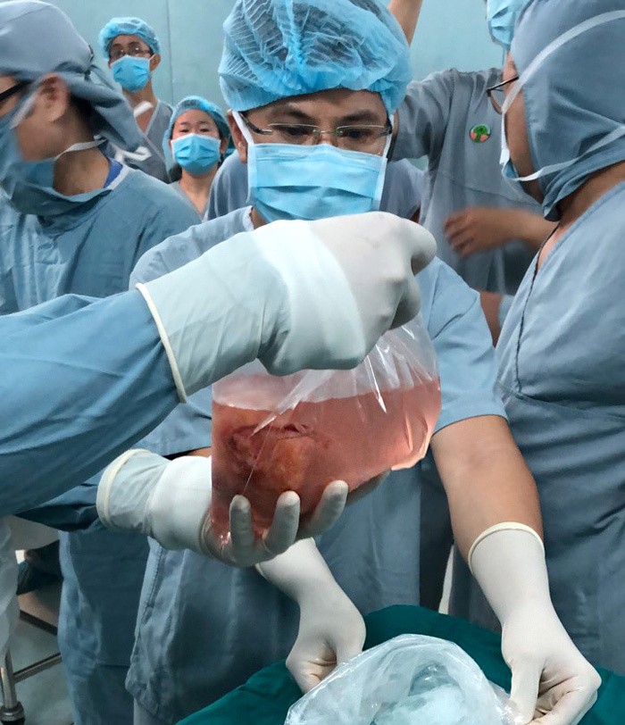 Quả thận của người chết não vượt 1.500 cây số cứu sống bệnh nhi ảnh 2