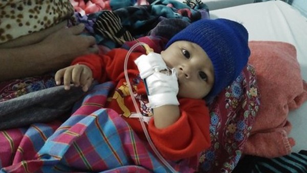 Bé 5 tháng tiểu ra máu, thận đầy sỏi do mẹ cai sữa sớm ảnh 1