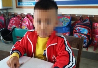 Chép nhầm đề, HS lớp 1 bị cô giáo tát 2 cái phải nhập viện ảnh 1