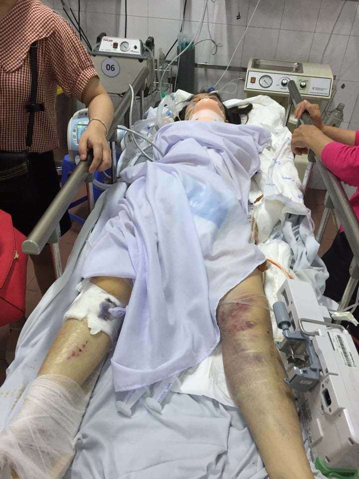 Sức khỏe nạn nhân bị xe điên tông trúng ở gầm cầu Mai Dịch giờ ra sao? ảnh 1