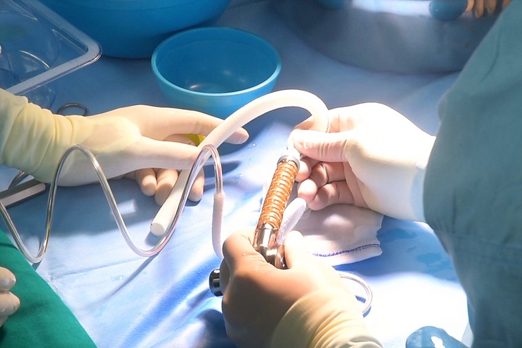 Vinmec cấy ghép thành công tim nhân tạo hỗ trợ tâm thất ảnh 4