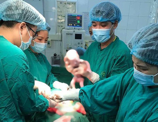 Hiếm gặp, thai phụ 9x sinh 3 cùng trứng ảnh 1