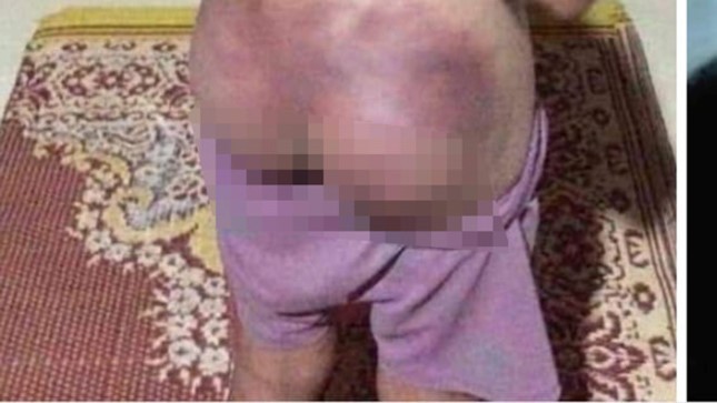 Công an viên thừa nhận còng tay, dùng gậy đánh bé gái thiểu năng ảnh 2