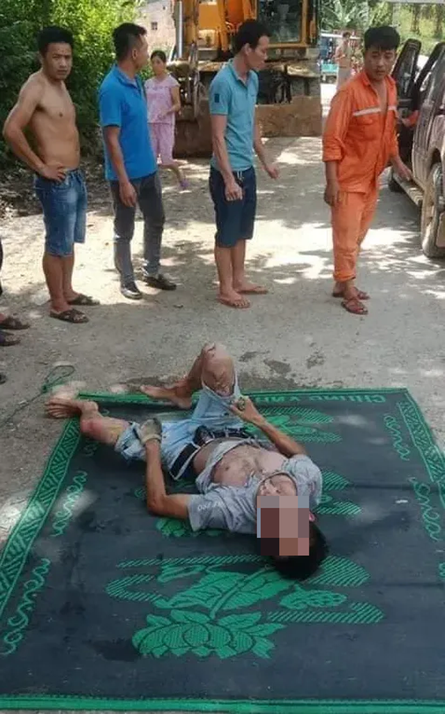 ‘Giải cứu’ xe tải vướng dây điện, tài xế bị điện giật trọng thương ảnh 2