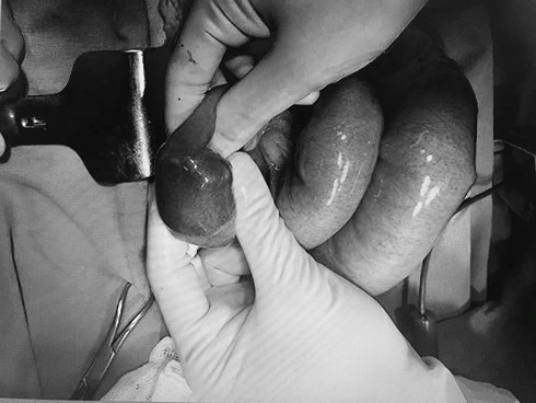 Nam thanh niên suýt chết vì uống trà sữa thay cơm ảnh 1