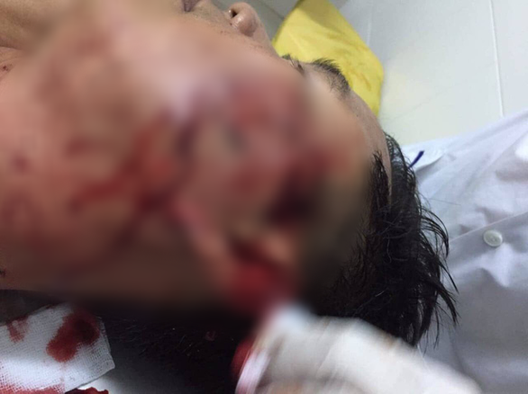 Xác định nguyên nhân vụ đại úy công an bị đánh trọng thương trong quán nhậu ảnh 1