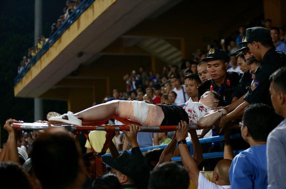 Trúng pháo sáng trên sân Hàng Đẫy, nữ cổ động viên phải trải qua 2 cuộc phẫu thuật ảnh 1