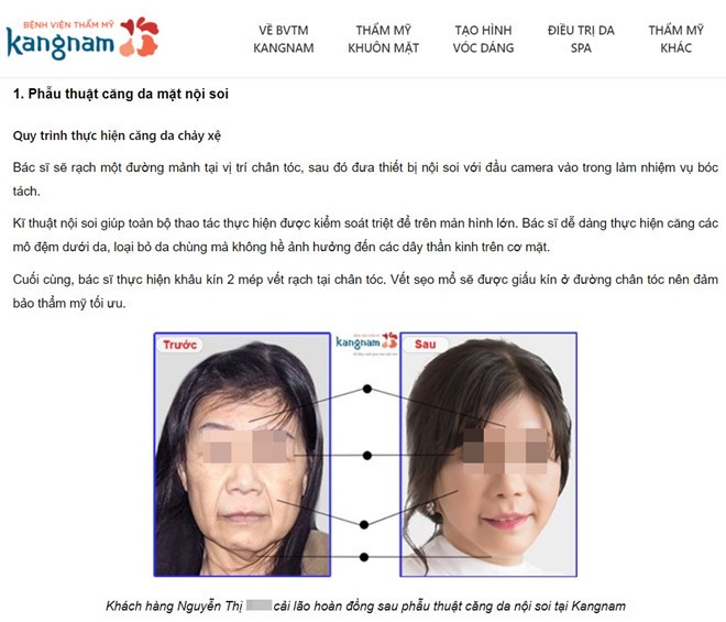 Xác minh rõ vụ Việt kiều Mỹ tử vong sau khi căng da mặt ở TP.HCM ảnh 1