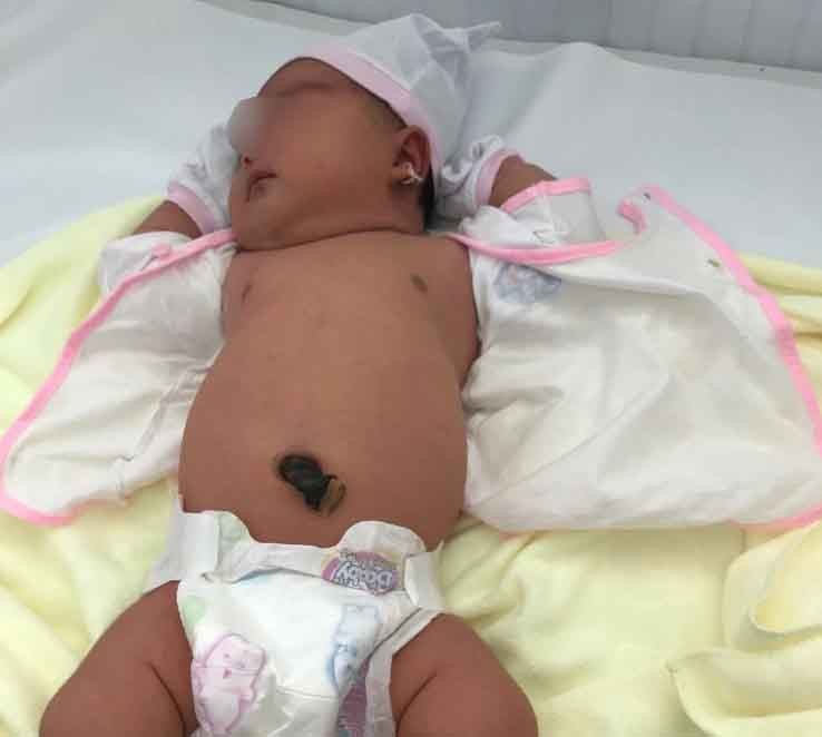 Bác sĩ phẫu thuật ngỡ ngàng với cân nặng ‘khổng lồ’ của bé gái sơ sinh ảnh 1