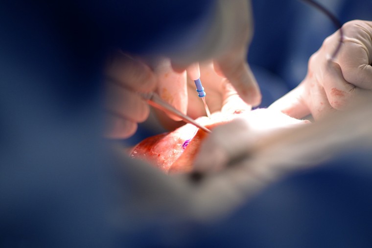 Tách thành công cặp song sinh dính liền ảnh 3