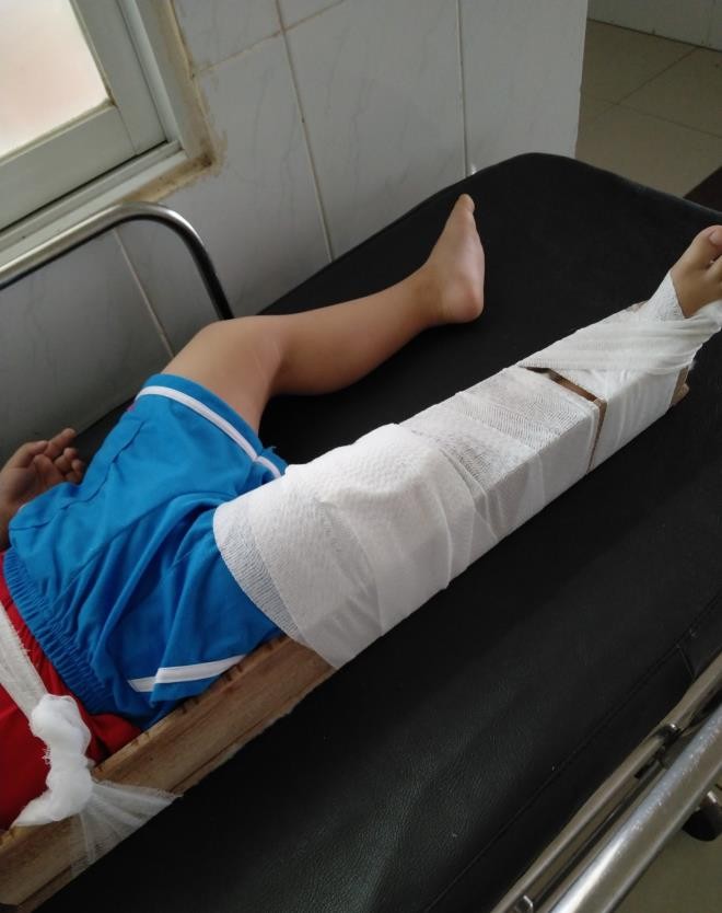 Tạm đình chỉ cô giáo làm bé 3 tuổi gãy xương đùi trong lớp ảnh 1