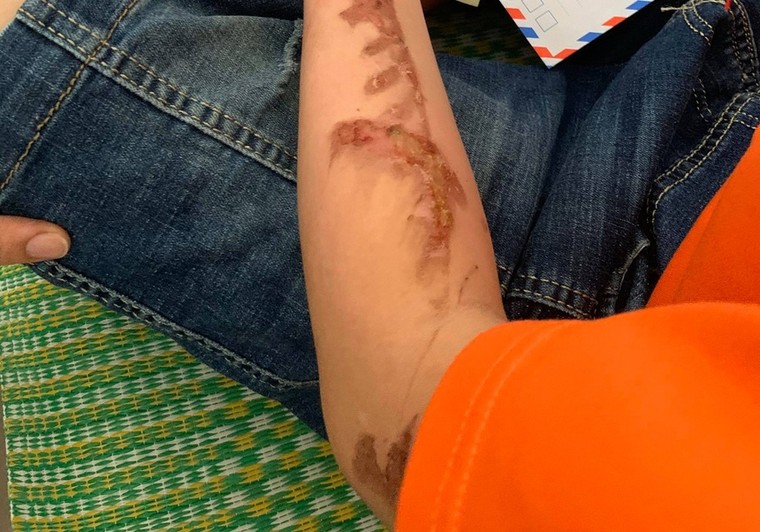 Vụ bạo hành nhân viên dã man ở Bắc Ninh: Chủ quán bánh xèo khai gì? ảnh 1