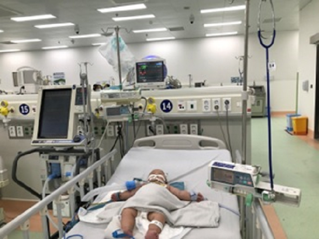 Nhiều trẻ nhập viện vì sốc sốt xuất huyết nặng ảnh 1