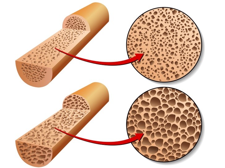 Những dấu hiệu cho thấy cơ thể thiếu vitamin B12 trầm trọng ảnh 7