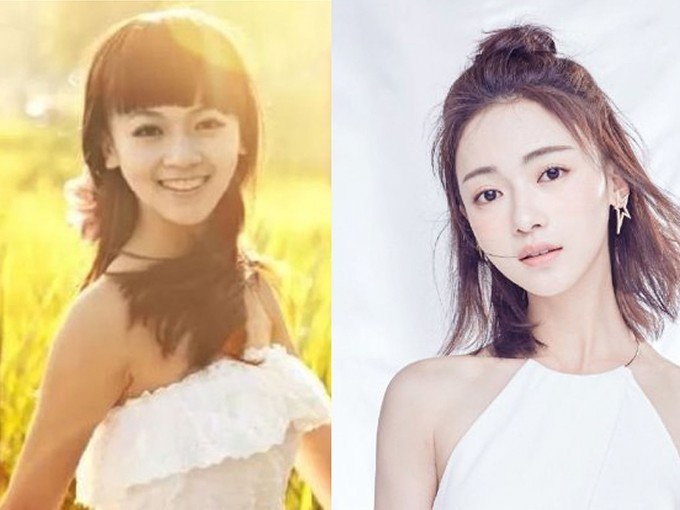 Nữ chính Diên Hi Công Lược dính nghi án phẫu thuật thẩm mỹ - 2