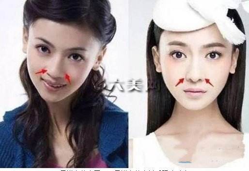 Nữ chính Diên Hi Công Lược dính nghi án phẫu thuật thẩm mỹ - 4