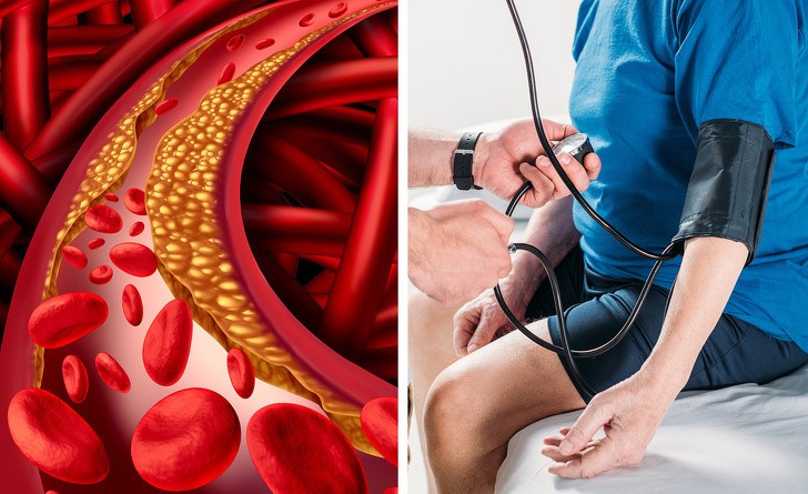 7 chung benh nguy hiem gay beo phi hinh anh 6