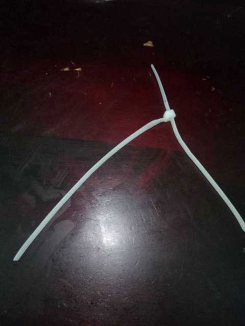 bé trai 6 tuổi suýt mất mạng vì luồn vòng dây nhựa thắt chặt cổ hình 2 be trai 6 tuoi suyt mat mang vi luon vong day nhua that chat co hinh 2