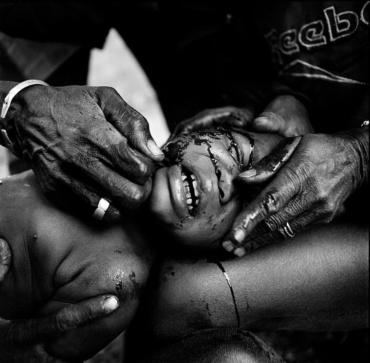 Rung minh hu tuc rach mat tre em danh dau tuoi truong thanh o Tay Phi hinh anh 6