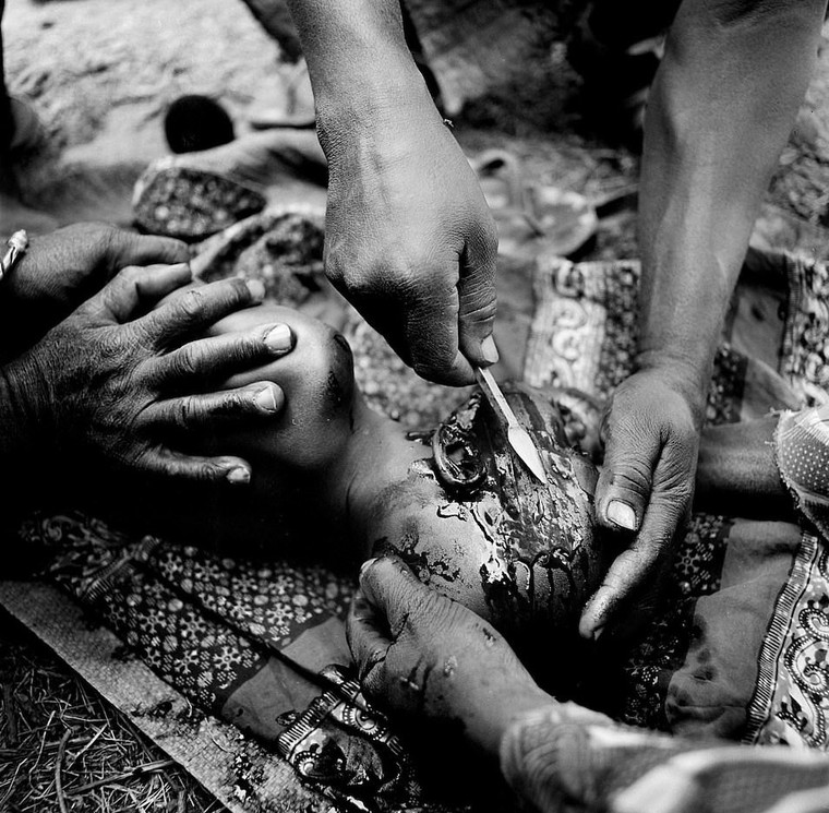 Rung minh hu tuc rach mat tre em danh dau tuoi truong thanh o Tay Phi hinh anh 7