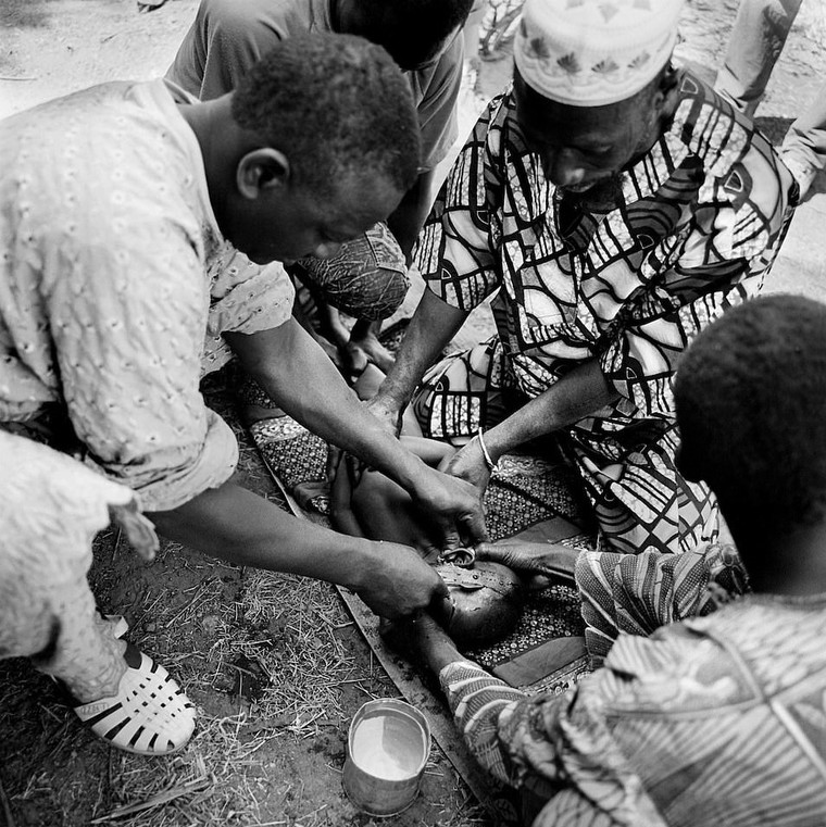 Rung minh hu tuc rach mat tre em danh dau tuoi truong thanh o Tay Phi hinh anh 16