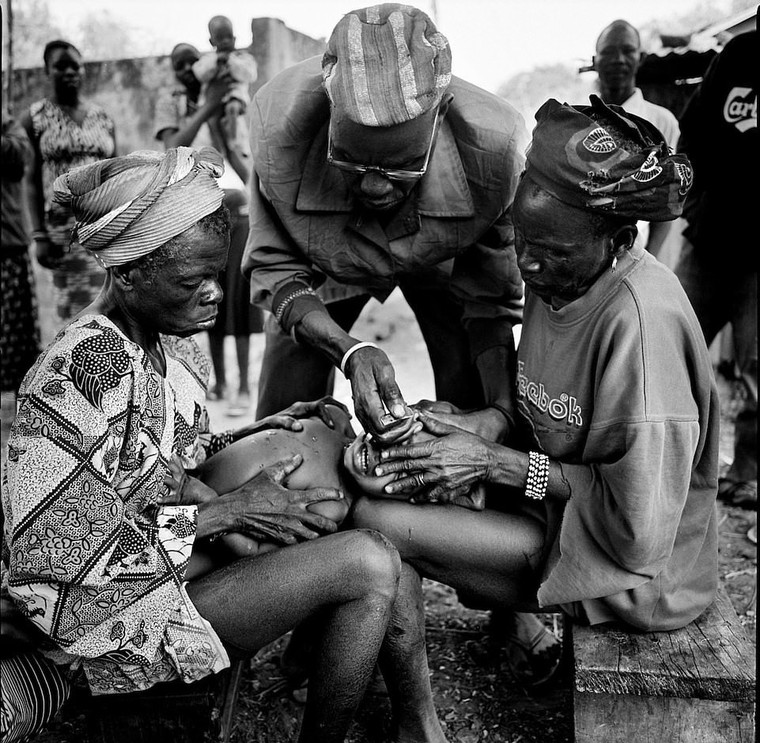 Rung minh hu tuc rach mat tre em danh dau tuoi truong thanh o Tay Phi hinh anh 3