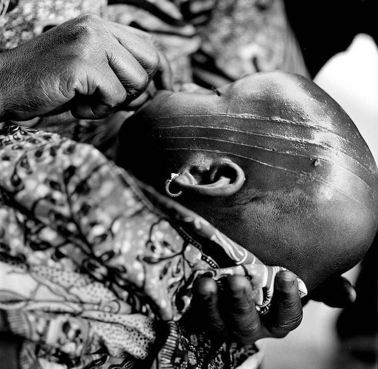 Rung minh hu tuc rach mat tre em danh dau tuoi truong thanh o Tay Phi hinh anh 2