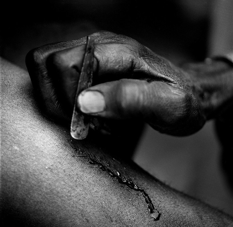 Rung minh hu tuc rach mat tre em danh dau tuoi truong thanh o Tay Phi hinh anh 5