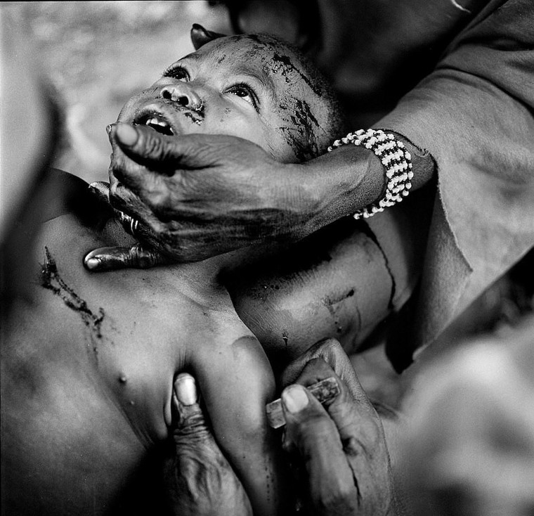 Rung minh hu tuc rach mat tre em danh dau tuoi truong thanh o Tay Phi hinh anh 4