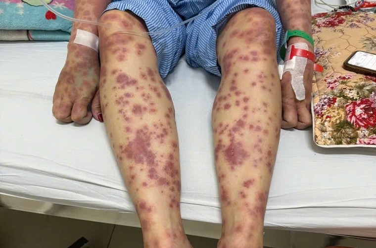 "Rước họa vào thân" từ những thói quen sử dụng thuốc, thực phẩm chức năng ảnh 1