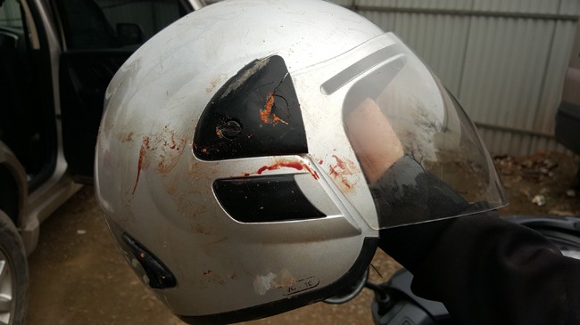 Nhà báo Đỗ Doãn Hoàng bị ba đối tượng lạ mặt dùng gậy đánh dã man ảnh 2