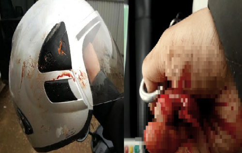 Nhà báo Đỗ Doãn Hoàng bị đánh bởi ít nhất 3 loại vật cứng ảnh 1