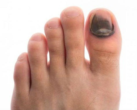 Dấu hiệu rõ rệt cho thấy bạn đã nhiễm HIV ảnh 5