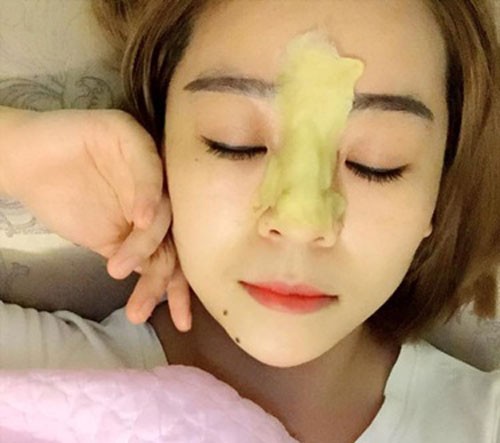 Cô nàng 9x khỏi bệnh viêm xoang mãn tính chỉ bằng... hạt gấc ảnh 5